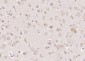 SLC25A1 Polyclonal Antibody